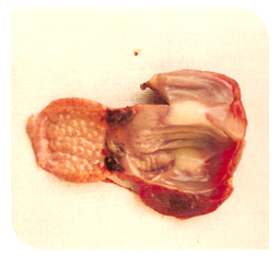 Haemorrhages in proventriculus & Gizzard junction